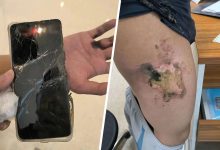 Фото - Мужчина получил серьезные ожоги при взрыве смартфона Redmi Note 11T Pro
